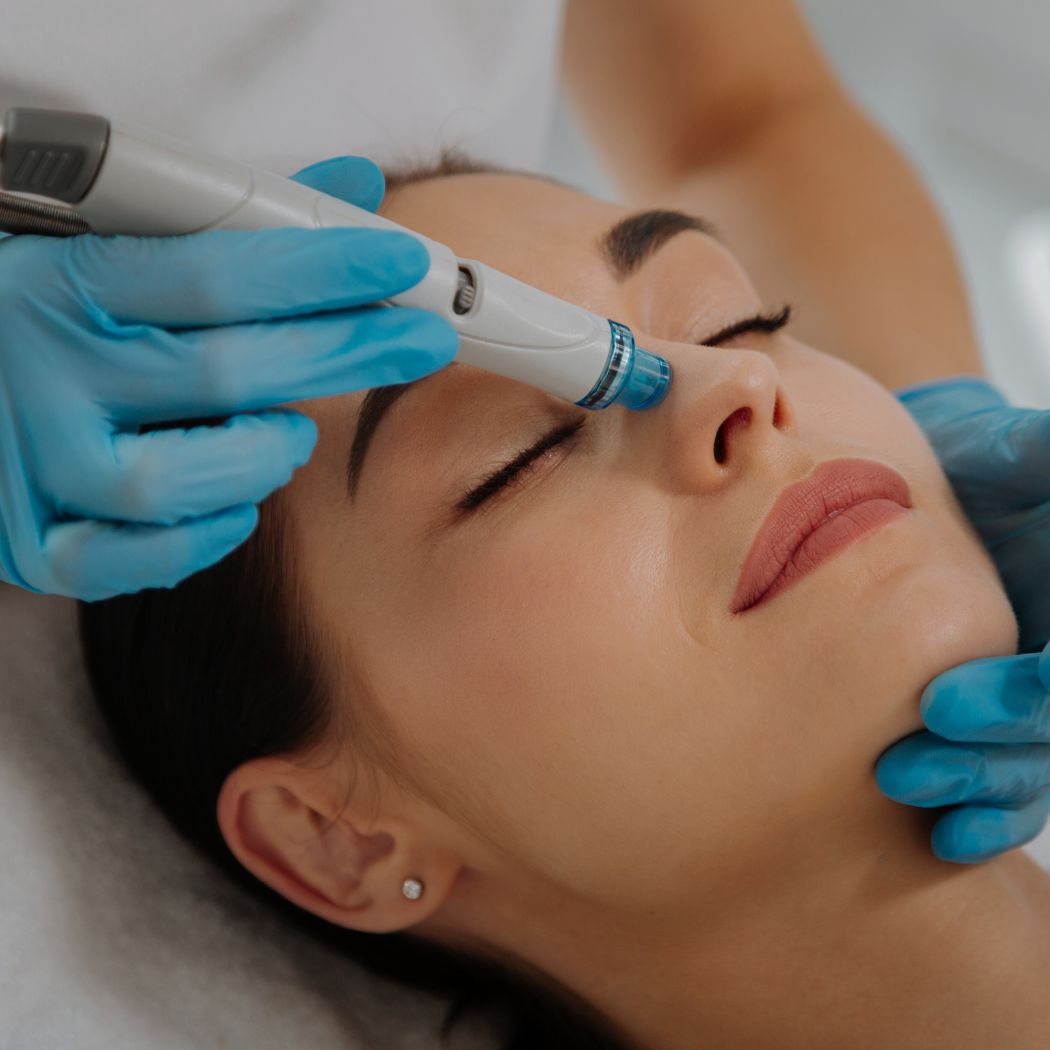 Beauty by Biska Offenbach am Main Aquafacial